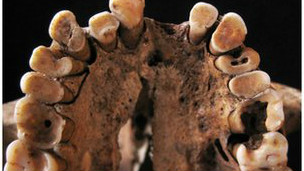 Taş Devri dönemine ait 13 bin 700 yıllık dişler